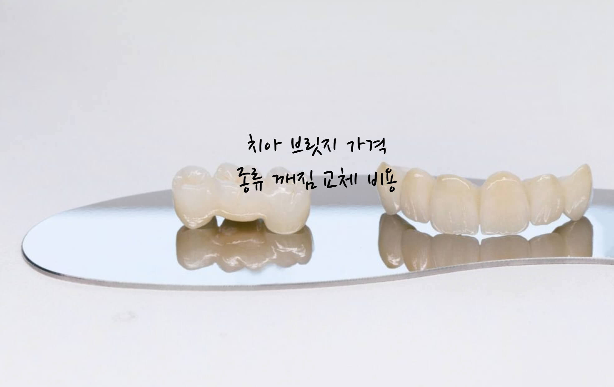 치아 브릿지