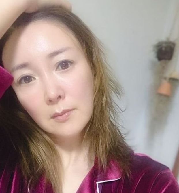 이상아 성형중독