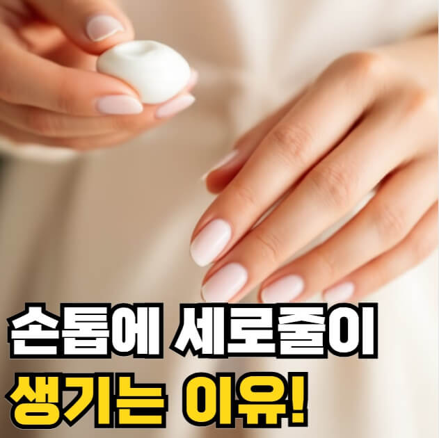 손톱에 세로줄이 생기는 이유