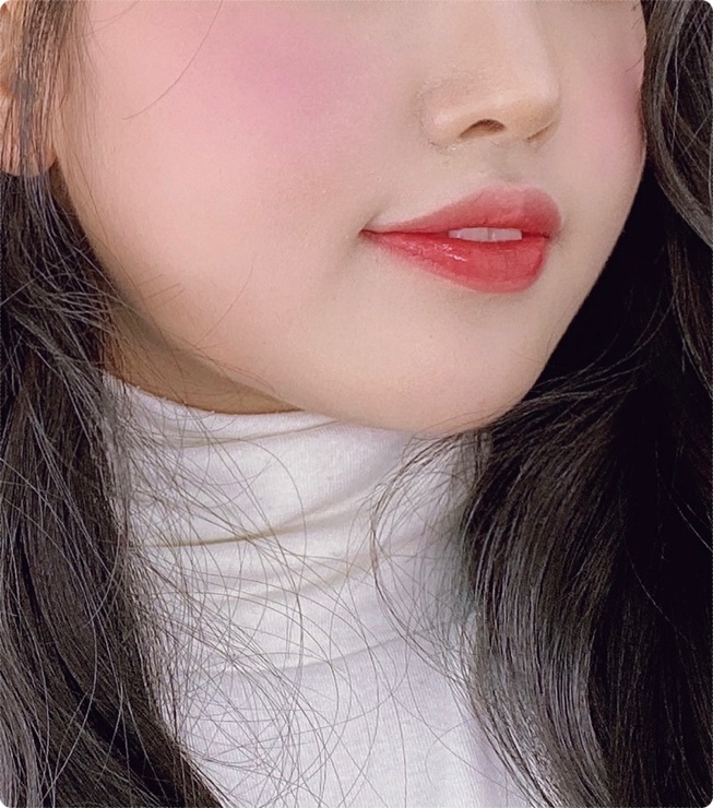 윤곽주사 후기