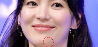입술 밑 점 관상 참고 정보_16
