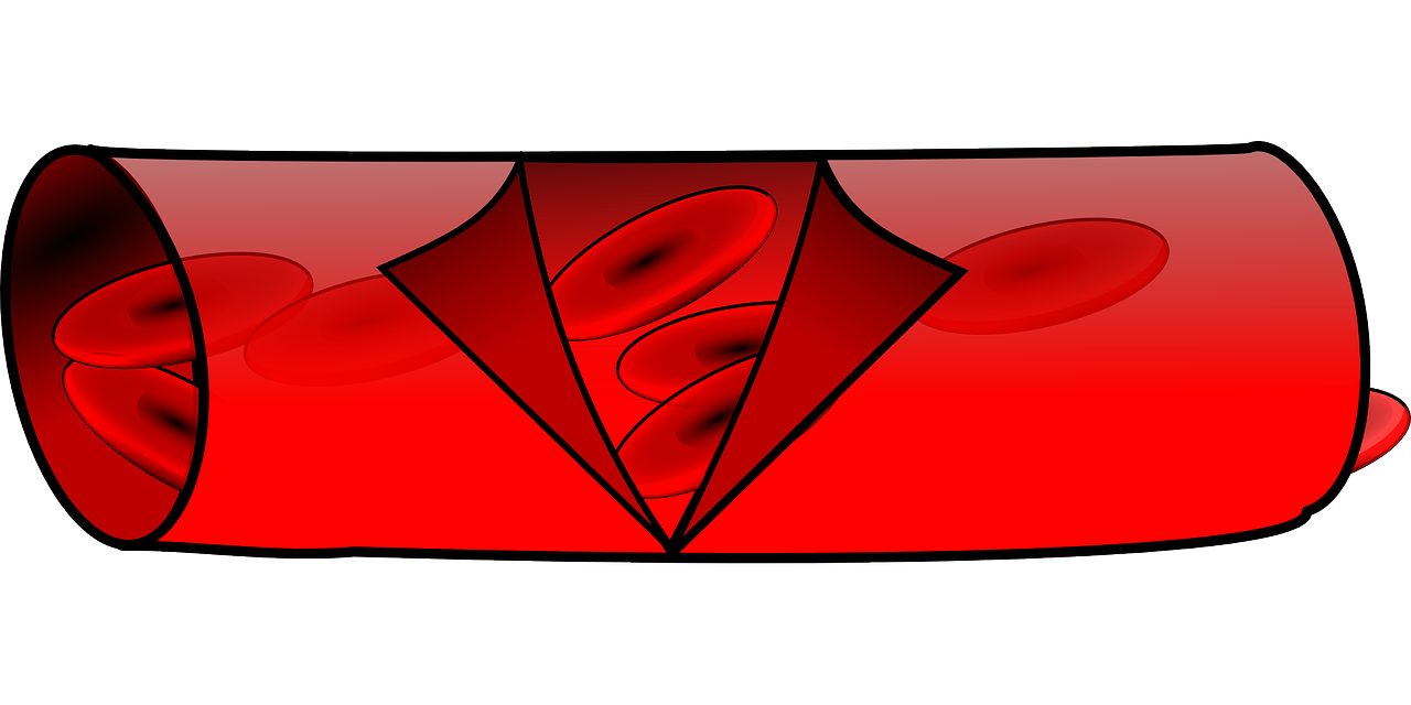 협심증 증상 사진