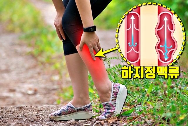 종아리 굵기 건강, 종아리 뜨거운 느낌, 팁줌