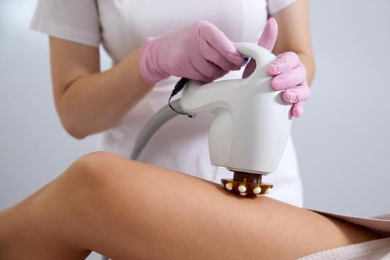 셀룰라이트 제거 시술