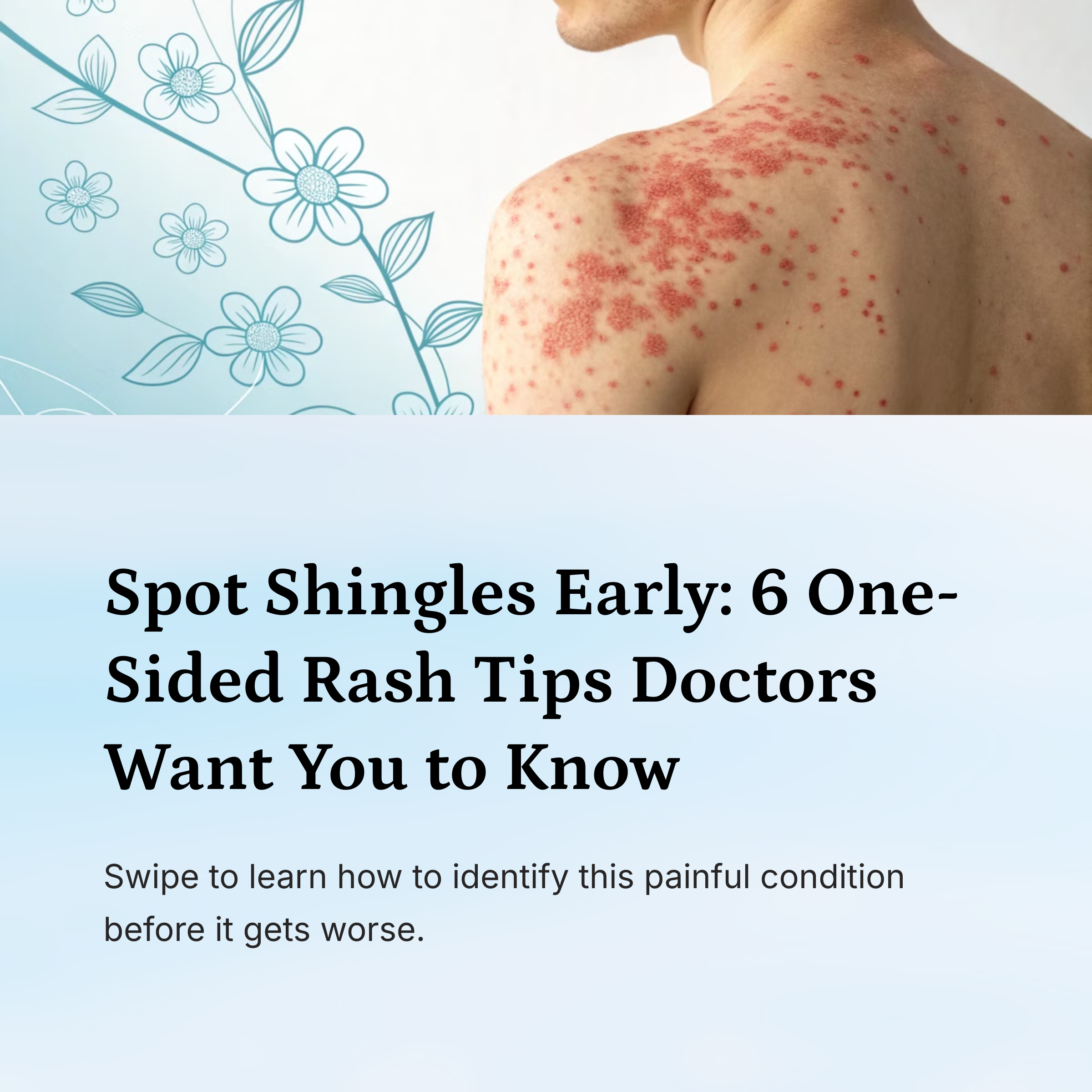 painful red shingles rash on one side of torso, medical close-up, clinical lighting