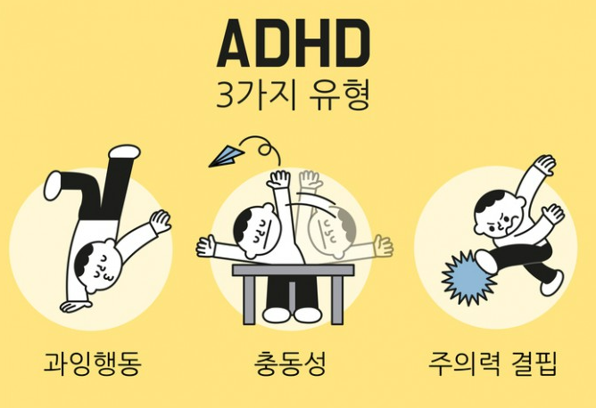 성인 ADHD 콘서타 약 먹고 부작용으로 속 울렁거려서 힘들었네요