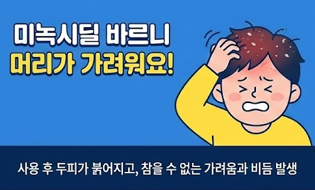 미녹시딜 부작용