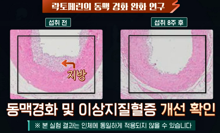 락토페린 효능