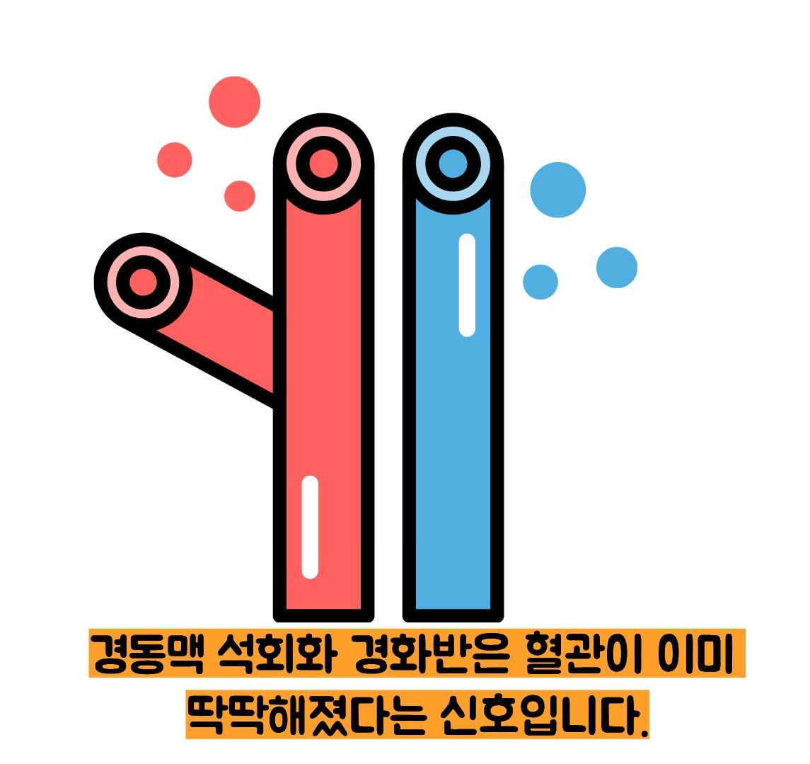 경동맥 석회화 경화반