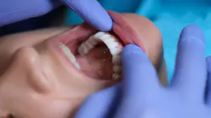 임플란트6