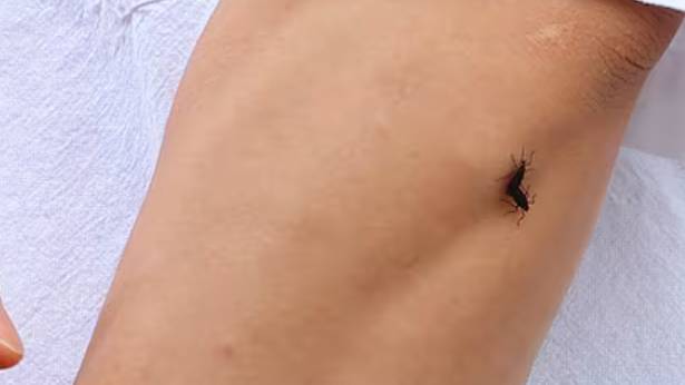 러브버그 퇴치방법