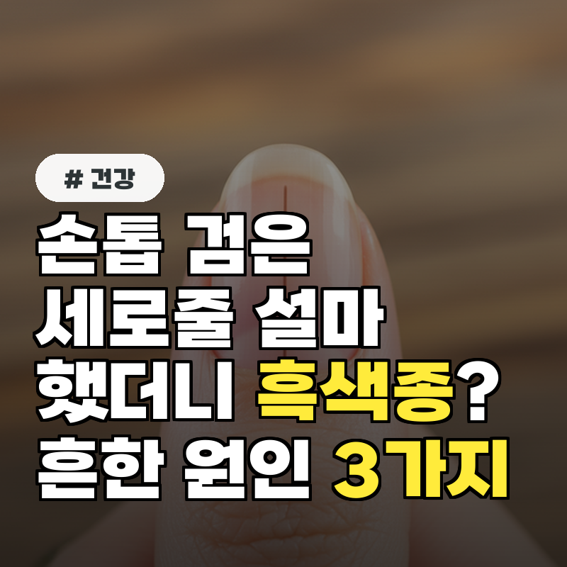 손톱 검은세로줄, 설마 했더니 흑색종 의외로 흔한 원인 3가지