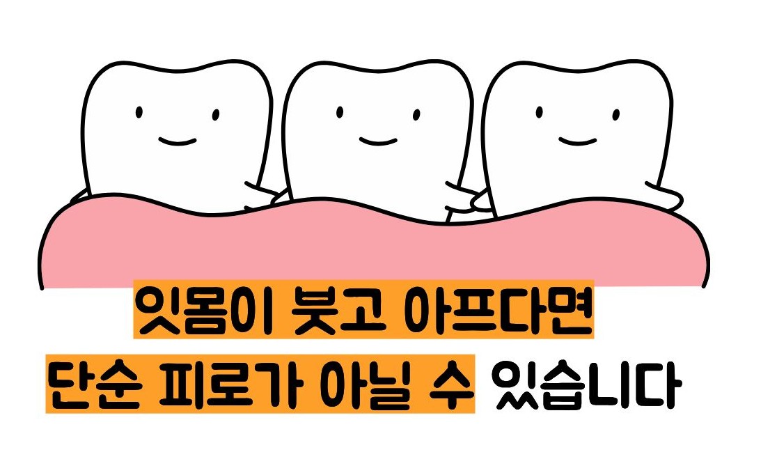 잇몸이 붓고 아플때