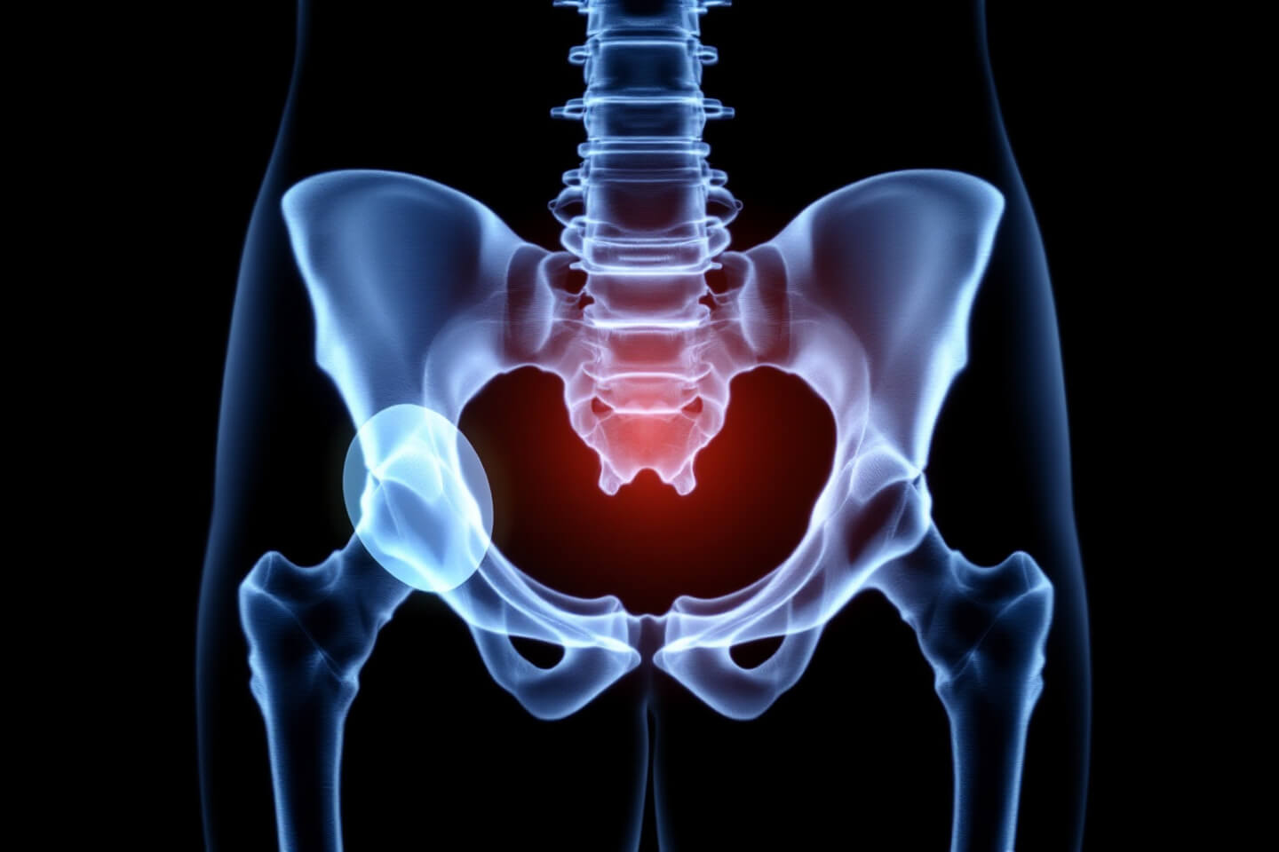 고관절 사진입니다.