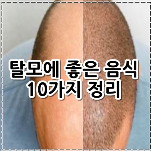 탈모에 좋은 음식 10가지 알아보기