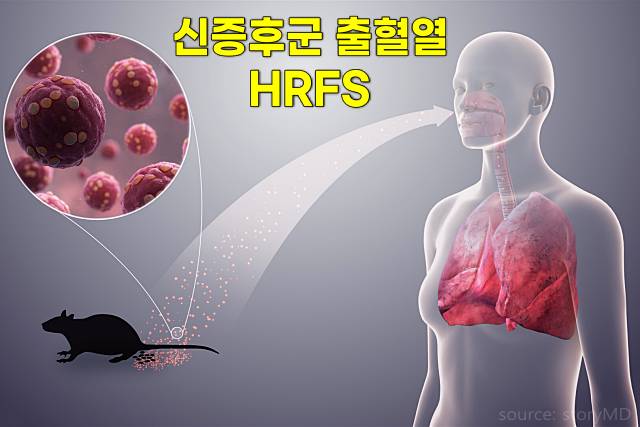 신증후군 출혈열 예방접종 시기 부작용 비용 무료