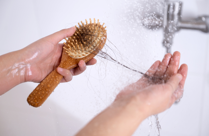 머리가 빠지는 현상 '탈모'