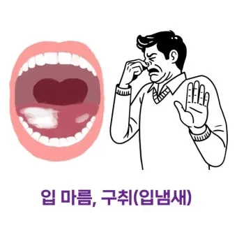 입이 쓴 증상 4가지 원인과 해결방법_21