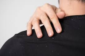 손톱에 세로줄이 생기는 이유