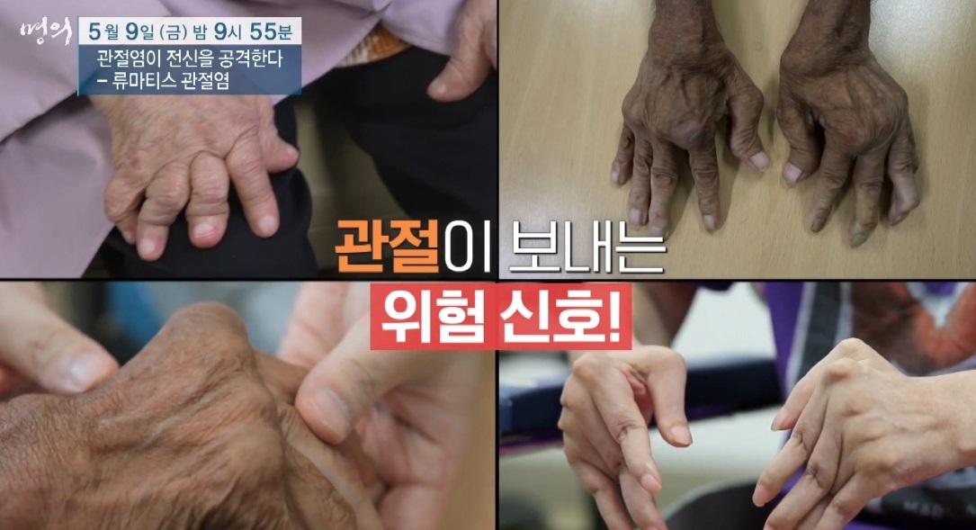 EBS명의-김완욱-교수