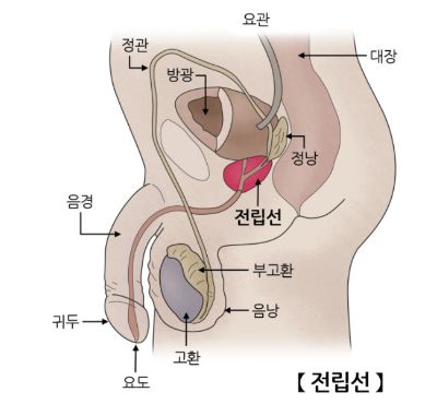전립선염 치료 방법