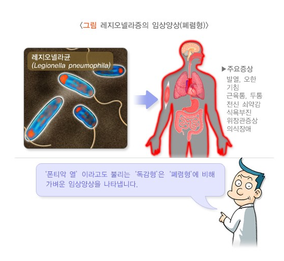 레지오넬라증 증상과 원인, 치료법