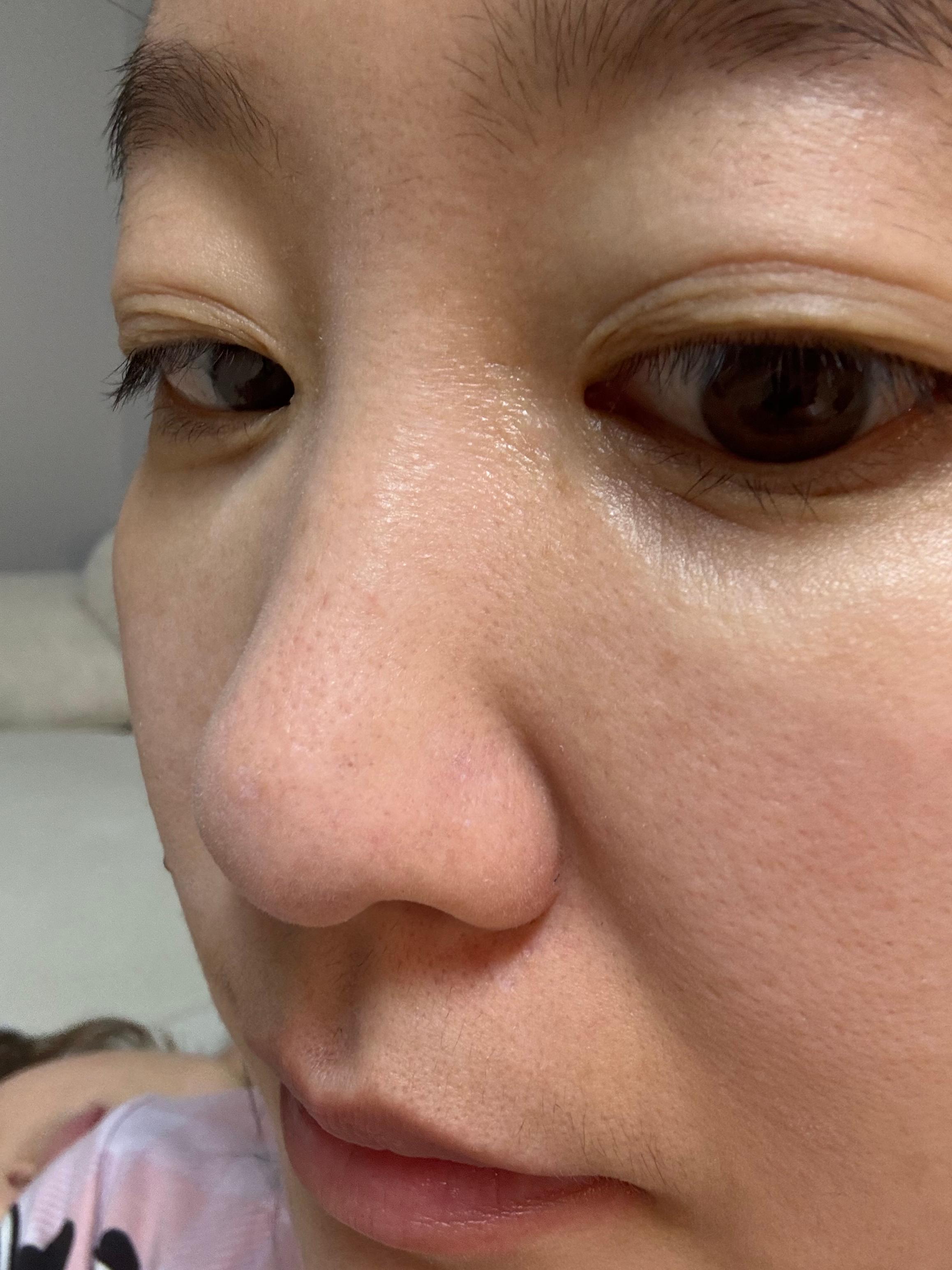 보나메두사 프라이머