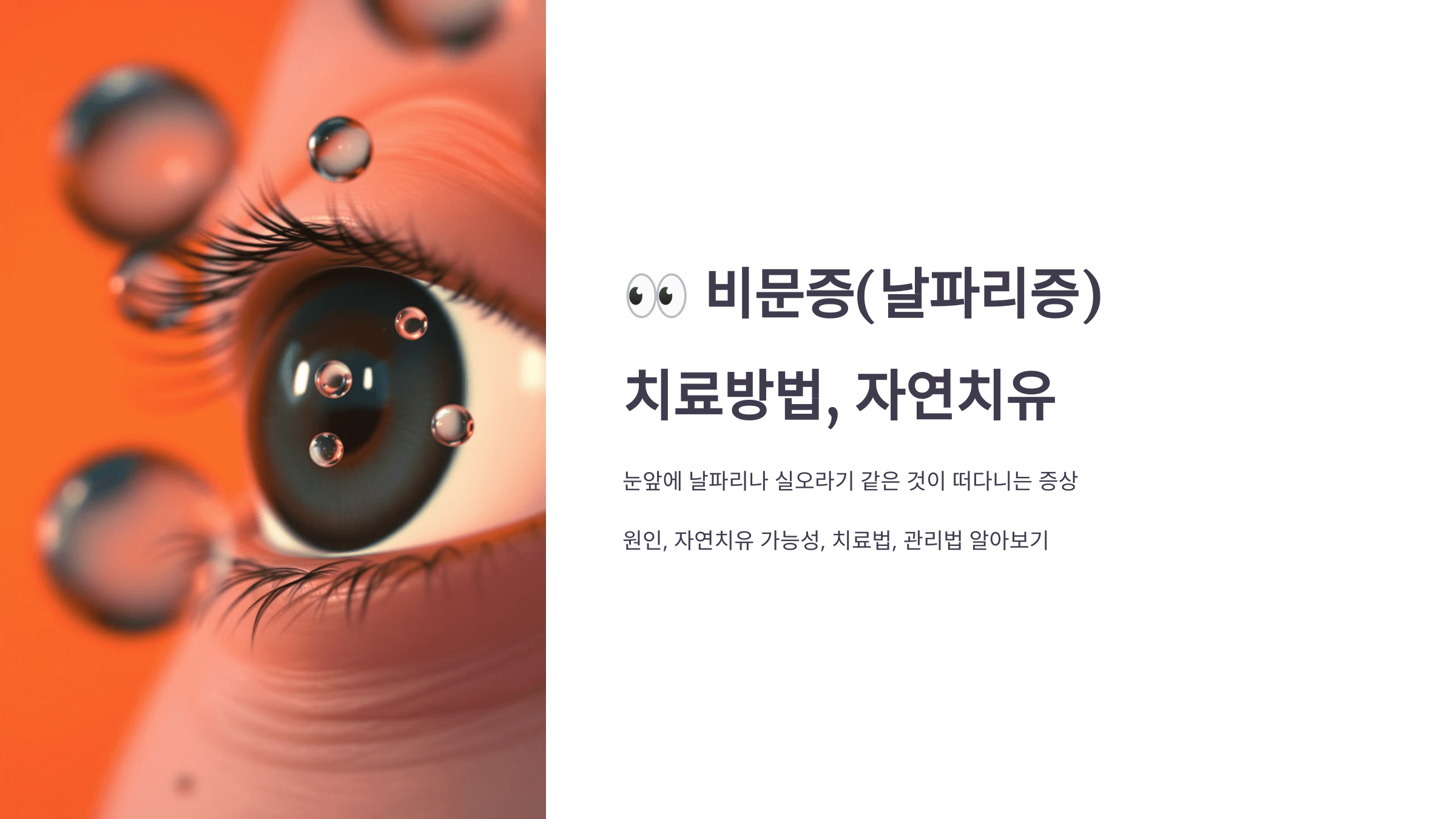 비문증과 관련된 사진입니다.