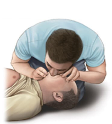 인공호흡 2회 시행