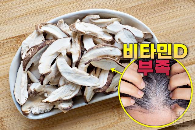 흰머리 없애는 음식 표고버섯 흰머리 검은머리로