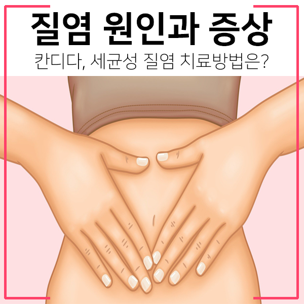 질염 원인과 증상 썸네일