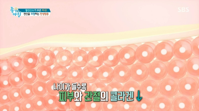 만성 염증 과 질환