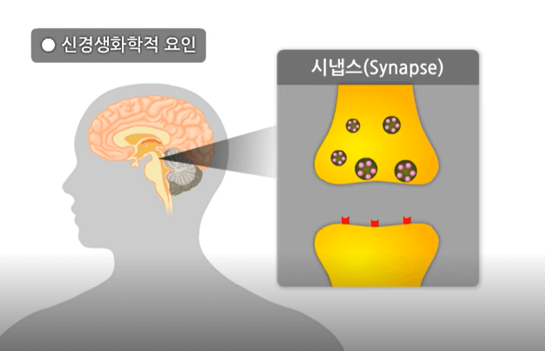 우울증의 생물학적 요인1