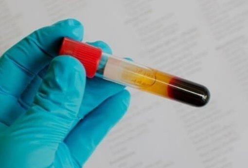 혈액형-유전원리