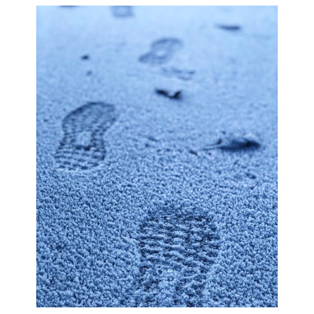 족저근막염과 관련된 사진입니다.