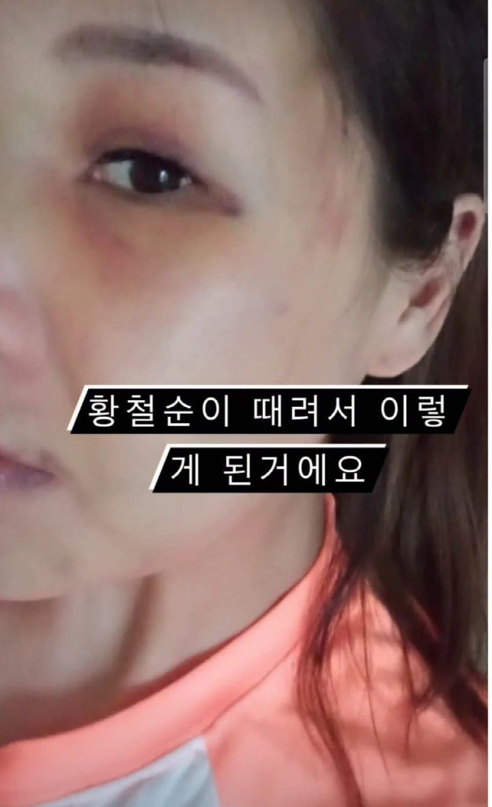 황철순 폭행
