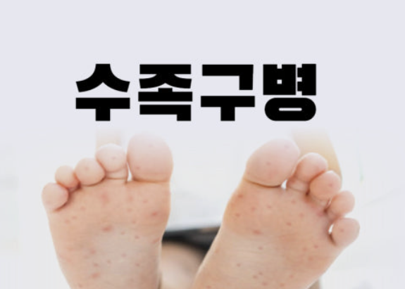 수족구 증상 - 아이 키우며 겪은 진짜 이야기