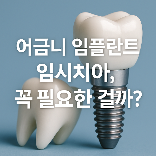 어금니 임플란트 임시치아, 꼭 필요한 걸까? 브릿지·위아래 차이·색깔 선택법