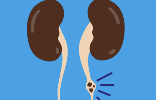 오른쪽 옆구리 통증 의심되는병