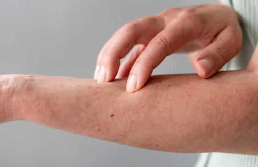 대상포진-예방-접종-비용-가격-4