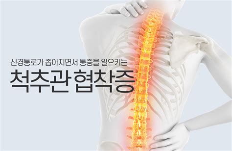 척추 협착증 원인