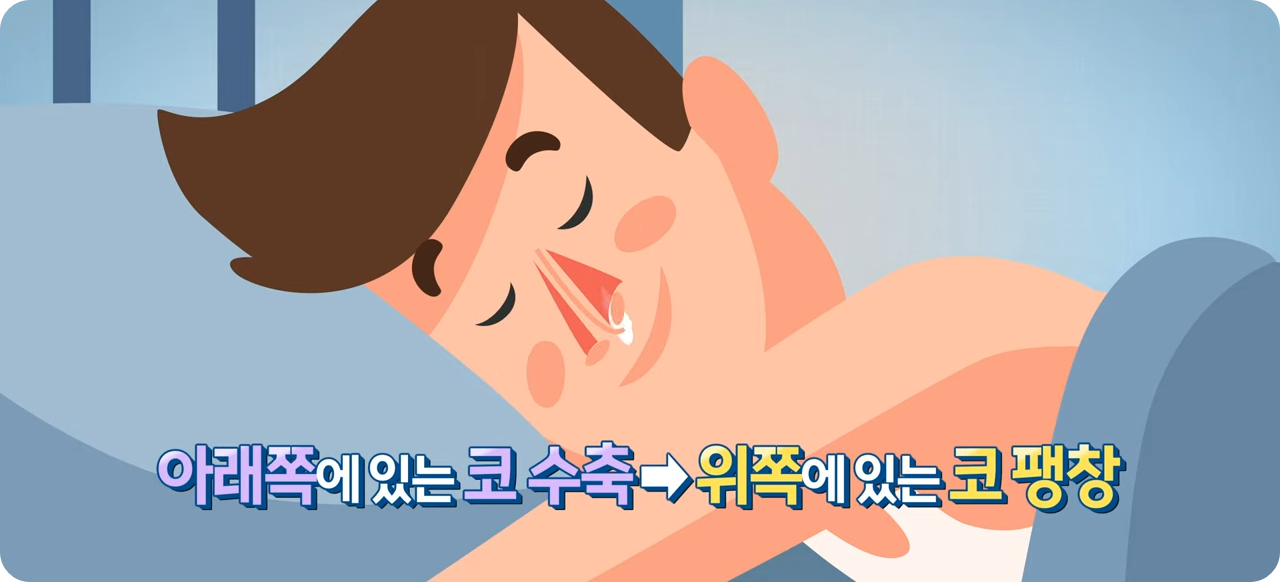 막힌 코의 팽창