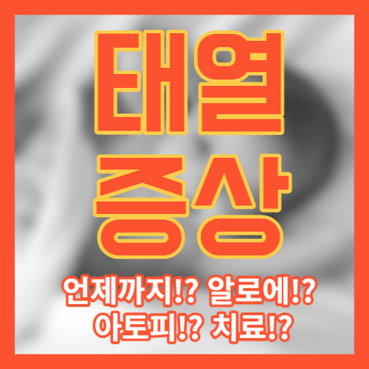 태열 증상 언제까지!? 알로에!? 아토피!? 치료!?
