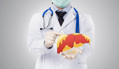 지방간 증상, 없애는 방법, 원인 총정리 (2024ver)