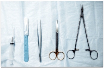 사마귀제거 방법