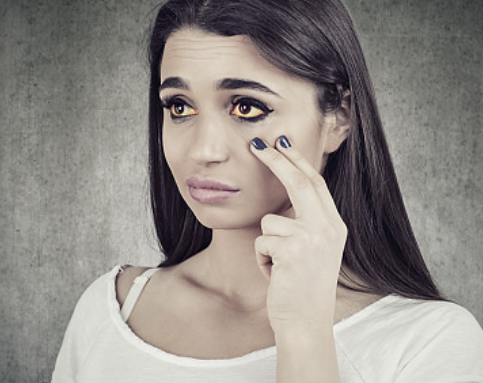 간경화 초기증상 14