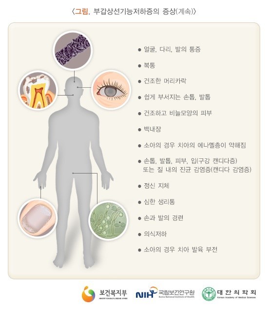 부갑상선 기능저하증