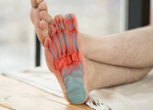 발바닥통증의 원인 12가지 총정리 섬네일