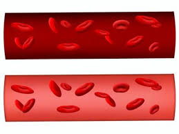 혈소판 수치 올리는 방법