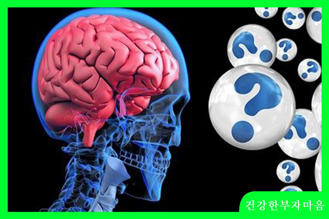 뇌출혈 전조증상